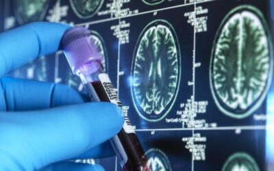 Hospital IV infusion setup symbolising the rollout of a new neurological therapy in India