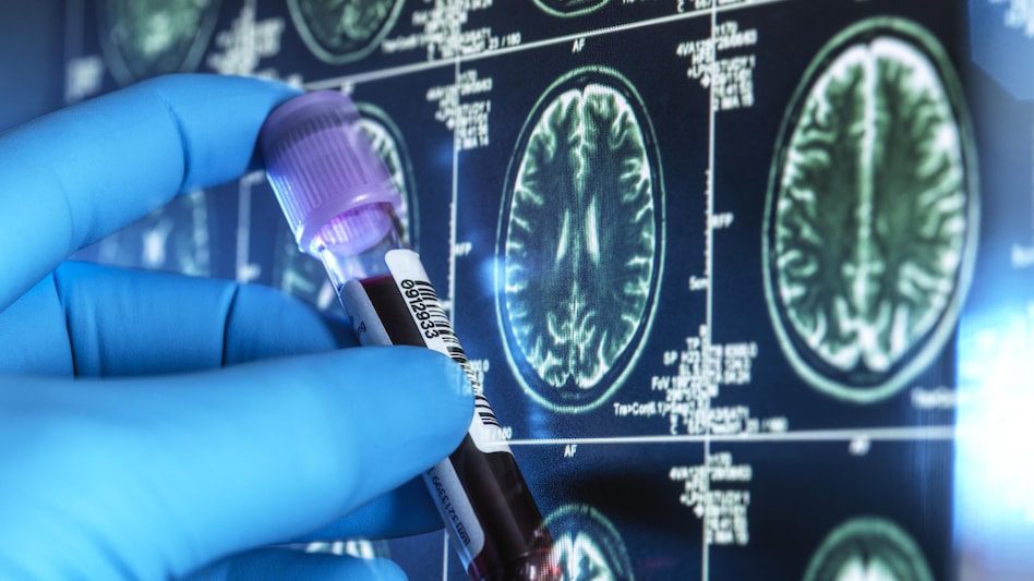 Hospital IV infusion setup symbolising the rollout of a new neurological therapy in India