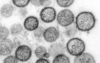 Electron micrograph of hantavirus particles
