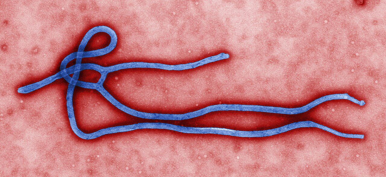 Coiled filamentous Ebola virus virion under electron microscope