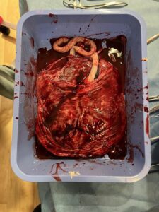 A Placenta on a Chip: How Indian Scientists Are Decoding Mother-to-Baby Transfer