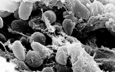Scanning electron micrograph of Yersinia pestis bacteria inside a flea