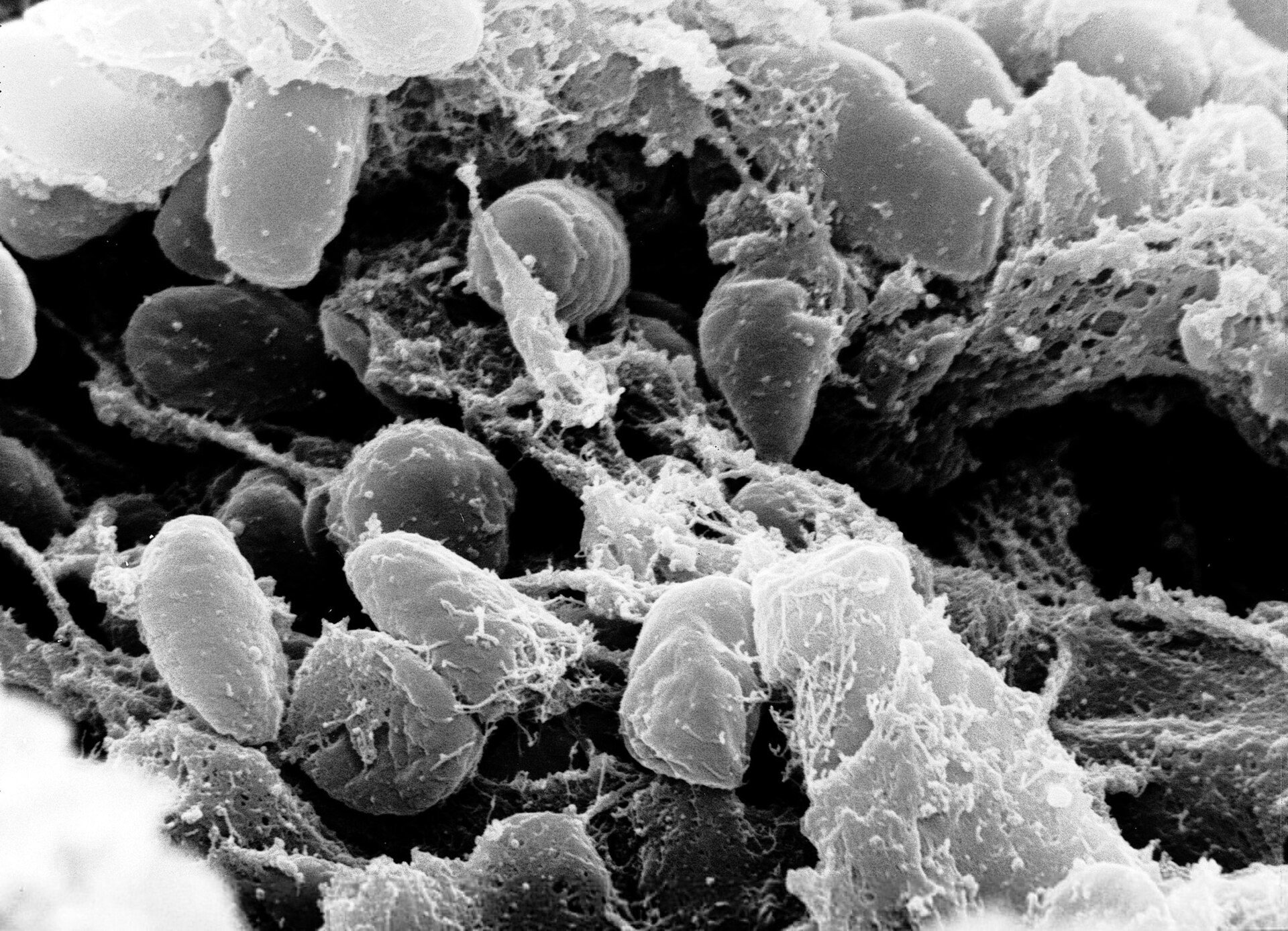 Scanning electron micrograph of Yersinia pestis bacteria inside a flea